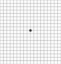 amsler grid testi